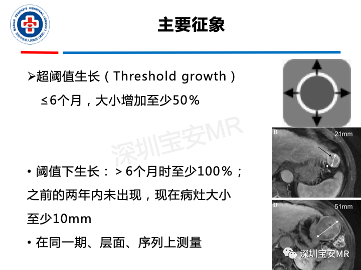 【PPT】原发性肝癌影像检查-22