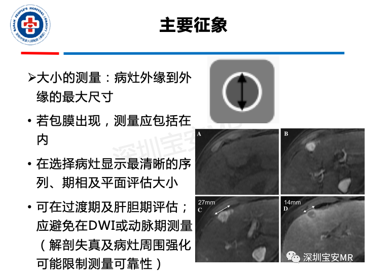 【PPT】原发性肝癌影像检查-23