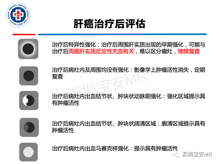 【PPT】原发性肝癌影像检查-33