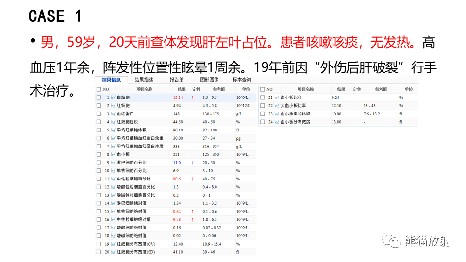 【PPT】肝内胆管细胞癌 VS 肝脓肿-2