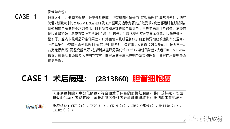 【PPT】肝内胆管细胞癌 VS 肝脓肿-24