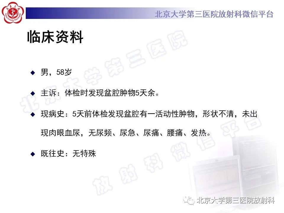 【PPT】胃肠道间质瘤-2