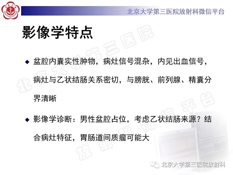 【PPT】胃肠道间质瘤-10