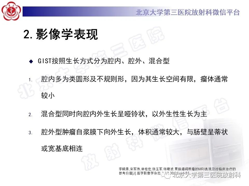 【PPT】胃肠道间质瘤-15