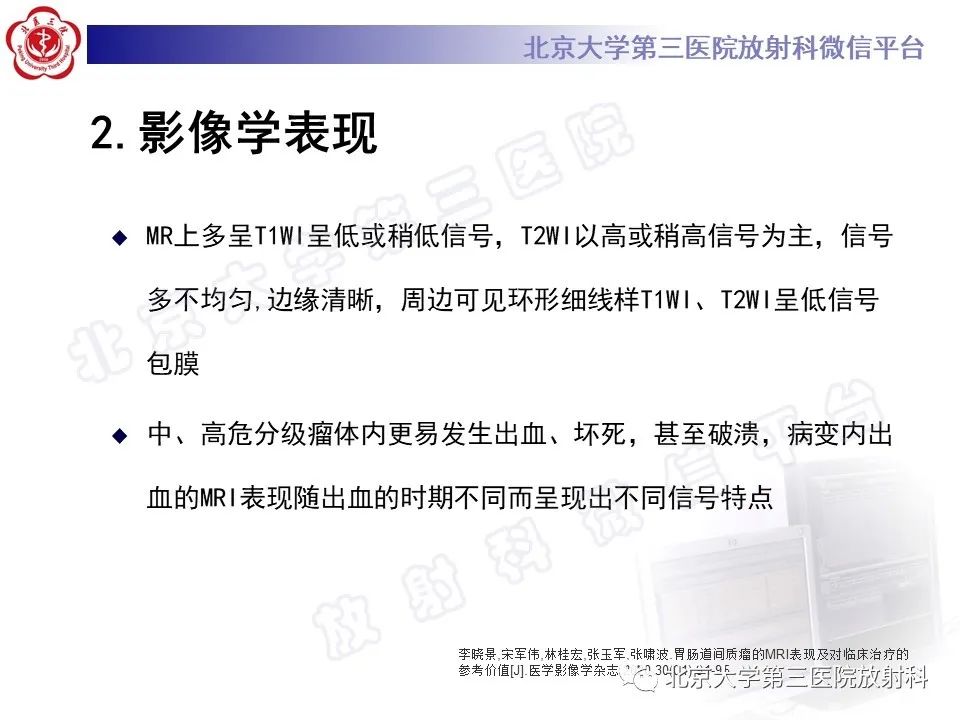 【PPT】胃肠道间质瘤-17