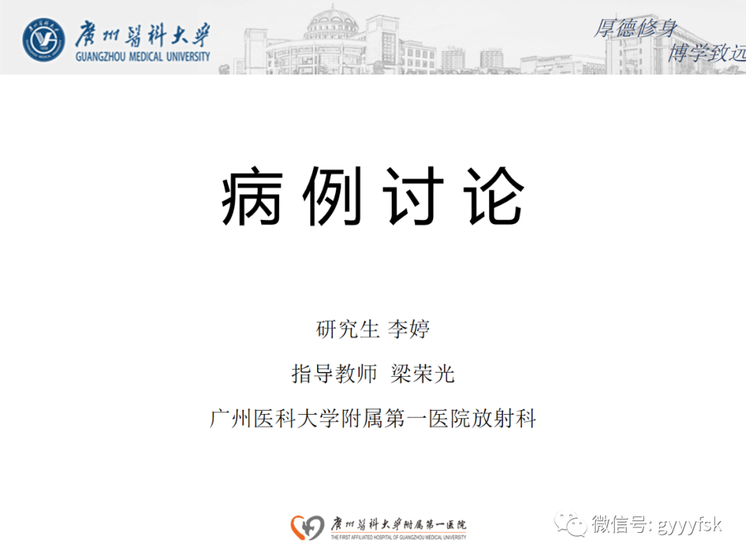 【病例】正中弓状韧带压迫综合征1例CT影像-1