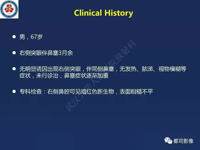 【PPT】鼻腔鼻窦转移瘤1例影像诊断