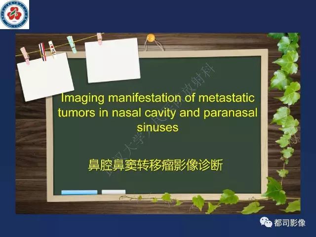 【PPT】鼻腔鼻窦转移瘤1例影像诊断