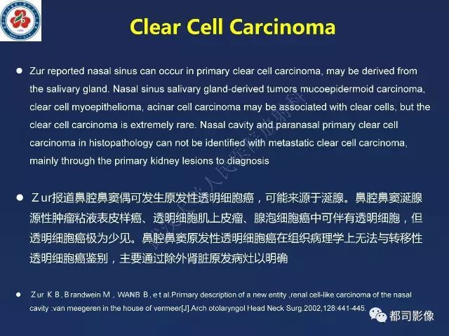 【PPT】鼻腔鼻窦转移瘤1例影像诊断