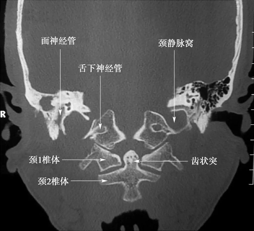 十二对脑神经影像解剖图谱-31