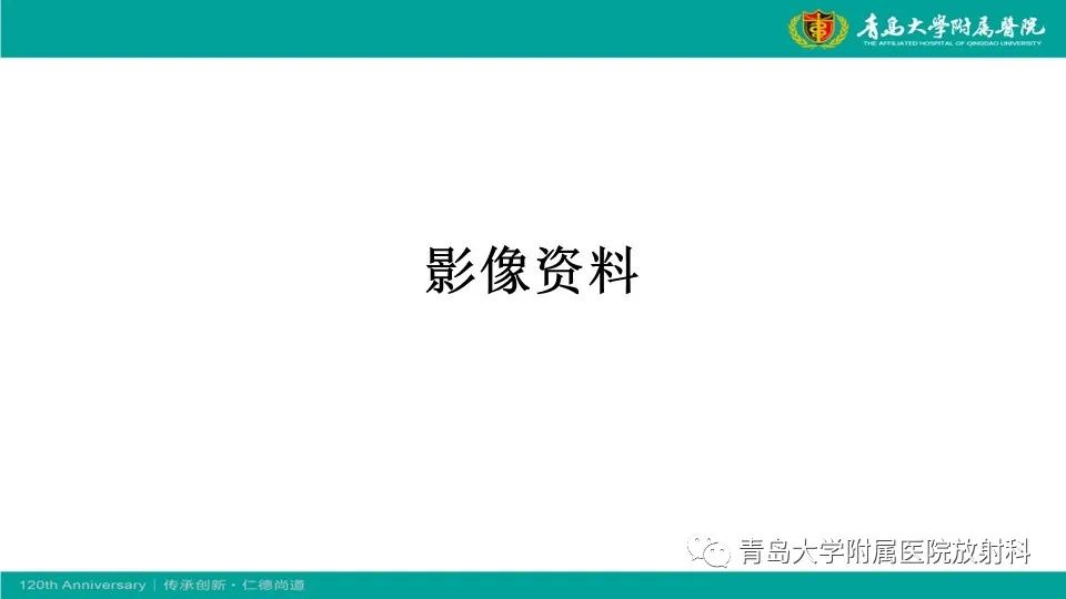 【病例】原发性中枢神经系统淋巴瘤1例CT及MR影像-3