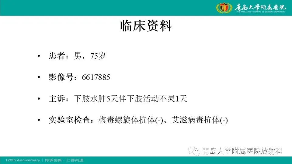 【病例】原发性中枢神经系统淋巴瘤1例CT及MR影像-2