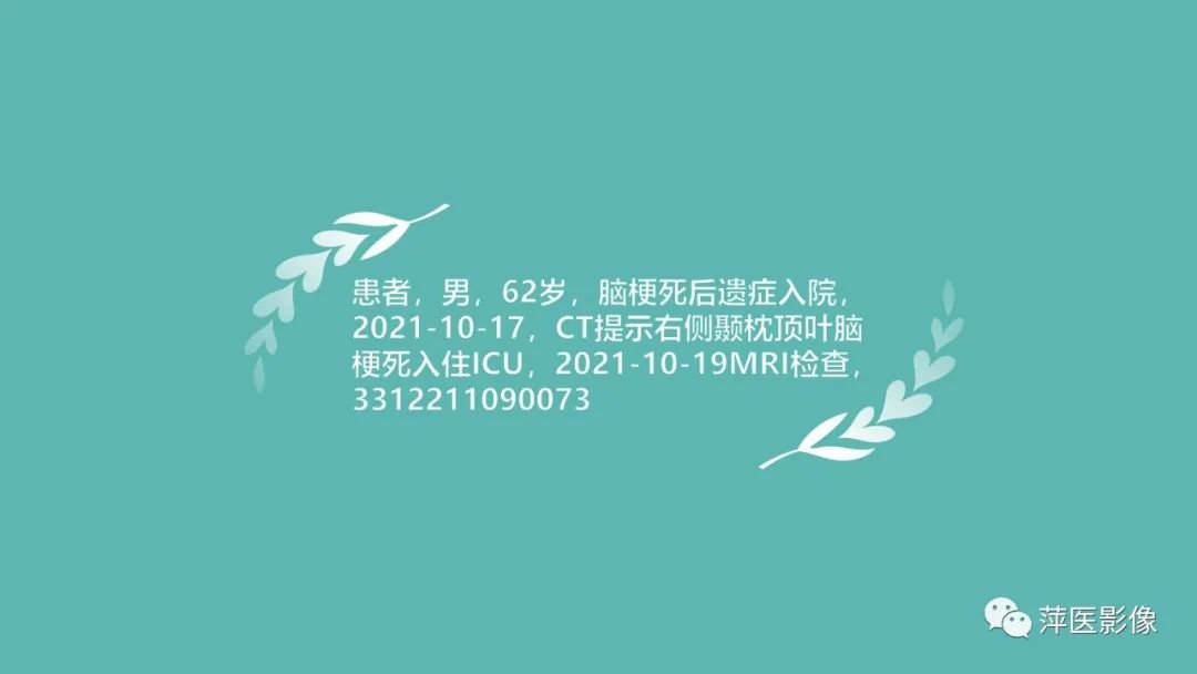 【PPT】脑皮质层状坏死的影像诊断-4