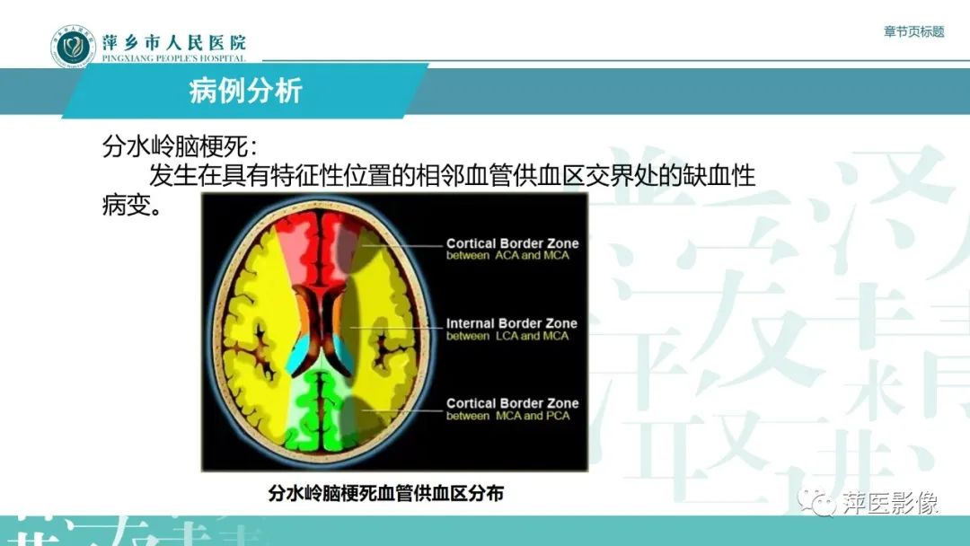 【PPT】脑皮质层状坏死的影像诊断-8