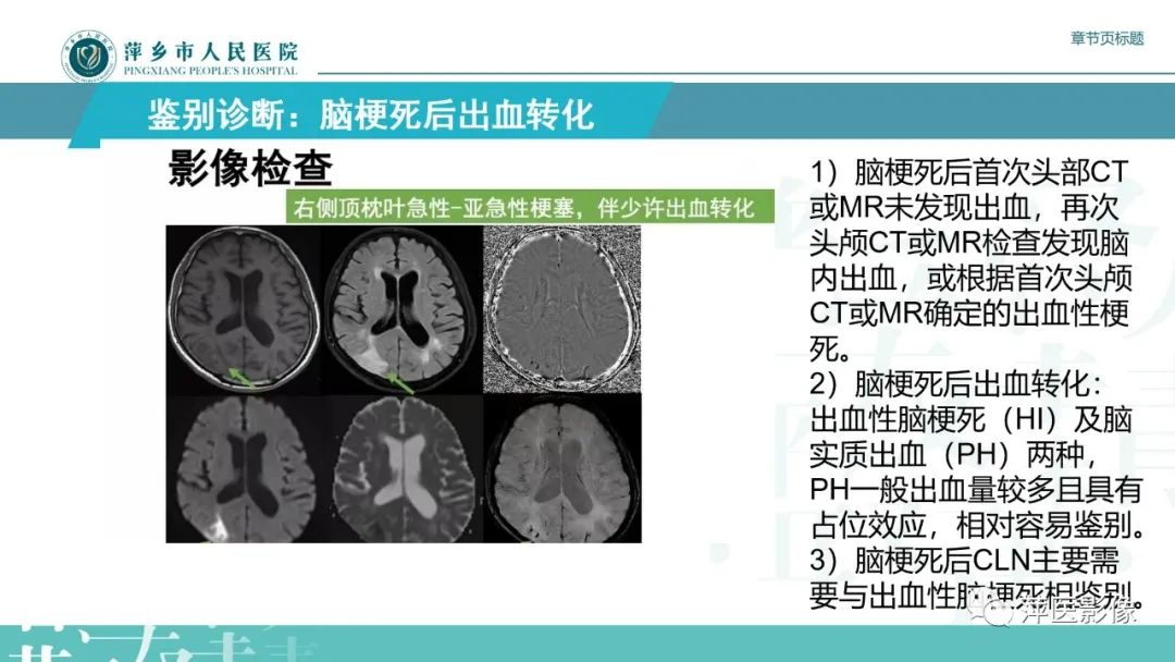 【PPT】脑皮质层状坏死的影像诊断-26