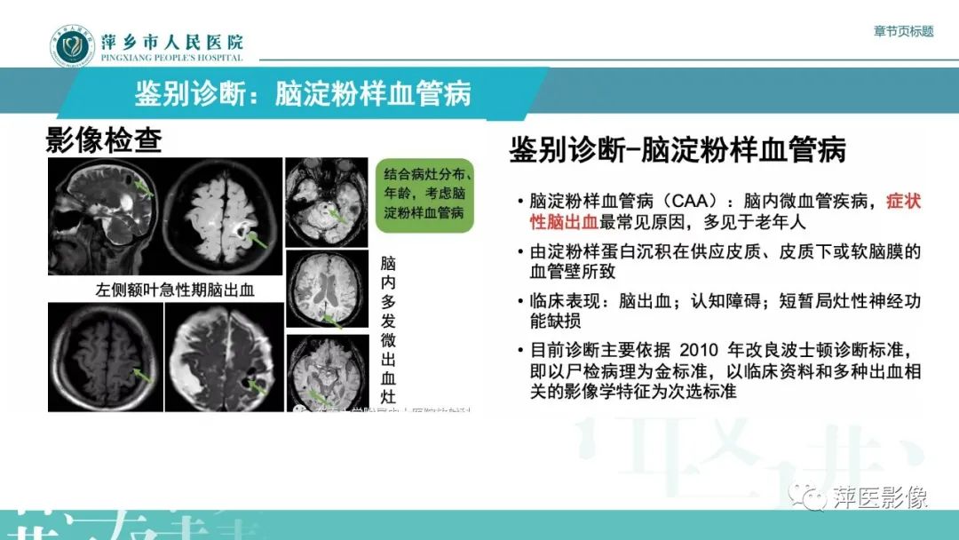 【PPT】脑皮质层状坏死的影像诊断-30