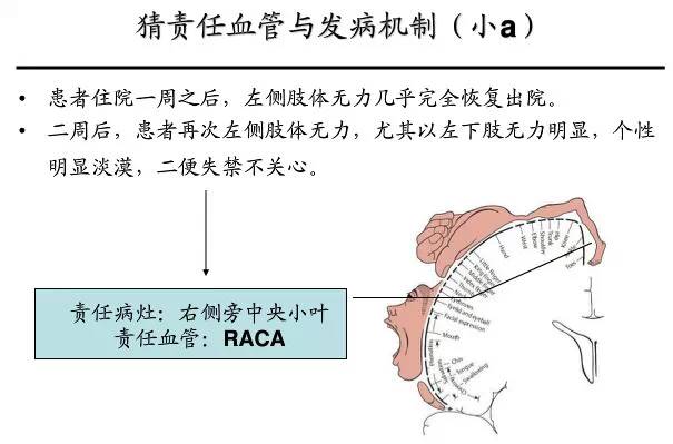 【PPT】猜责任血管与发病机制-2