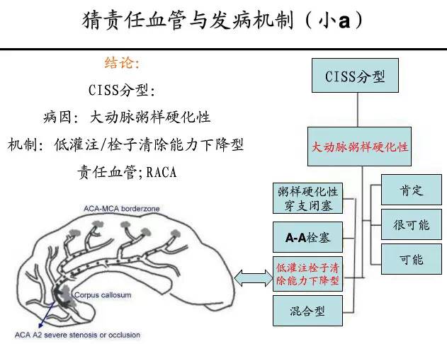 【PPT】猜责任血管与发病机制-9