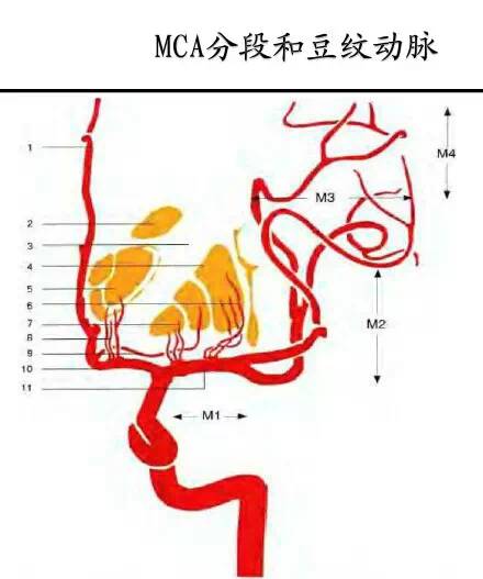 【PPT】猜责任血管与发病机制-14