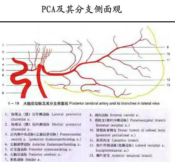 【PPT】猜责任血管与发病机制-17