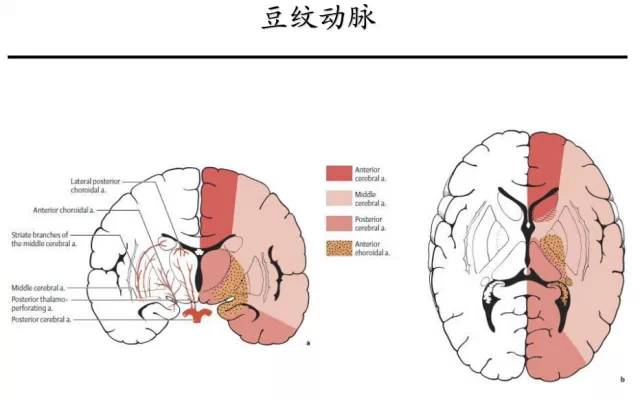 【PPT】猜责任血管与发病机制-18