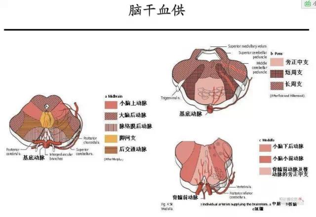 【PPT】猜责任血管与发病机制-19