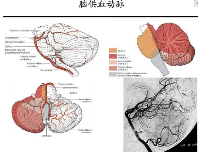 【PPT】猜责任血管与发病机制-22