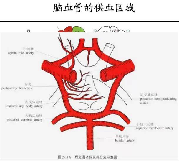 【PPT】猜责任血管与发病机制-27