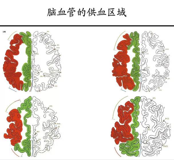 【PPT】猜责任血管与发病机制-30