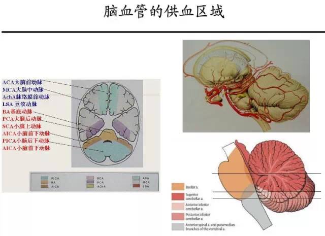 【PPT】猜责任血管与发病机制-31