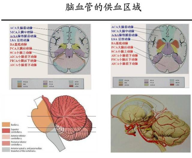 【PPT】猜责任血管与发病机制-32