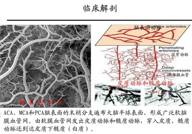 【PPT】猜责任血管与发病机制-35