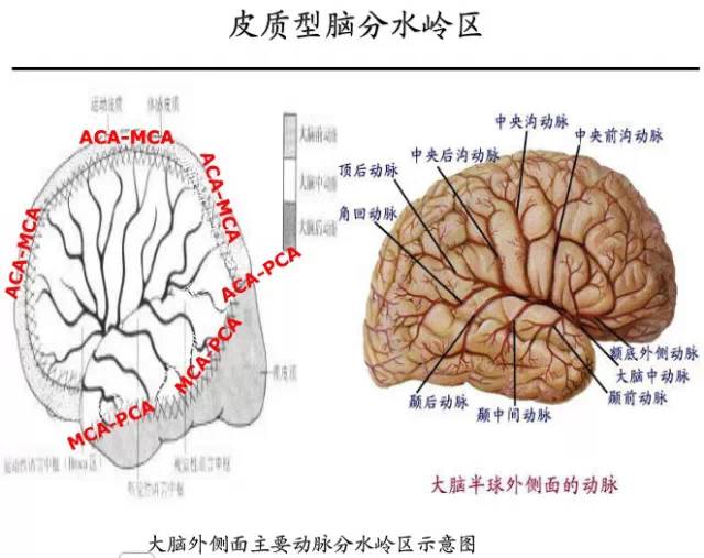 【PPT】猜责任血管与发病机制-43