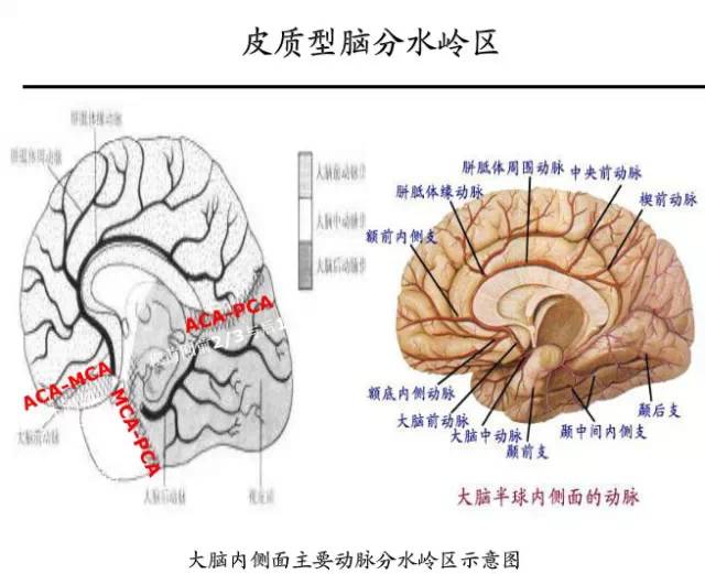 【PPT】猜责任血管与发病机制-44