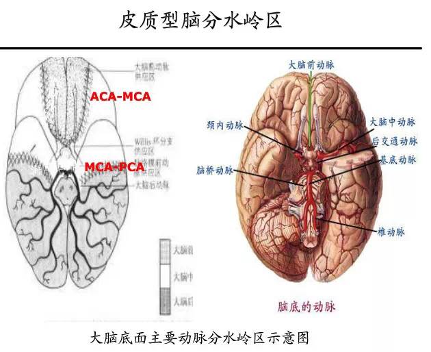 【PPT】猜责任血管与发病机制-45