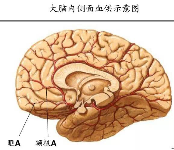 【PPT】猜责任血管与发病机制-47