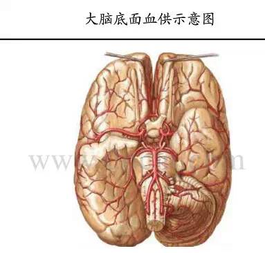 【PPT】猜责任血管与发病机制-48