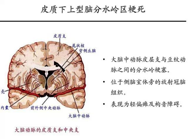 【PPT】猜责任血管与发病机制-53