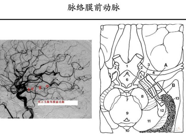 【PPT】猜责任血管与发病机制-98