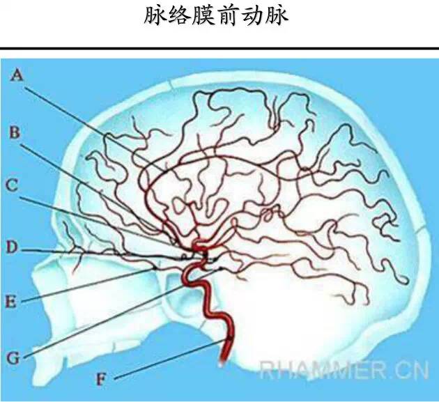 【PPT】猜责任血管与发病机制-99