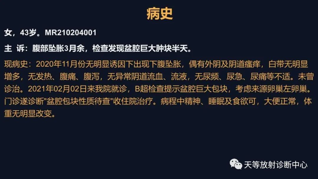 【病例】卵巢囊腺瘤1例MR影像-1