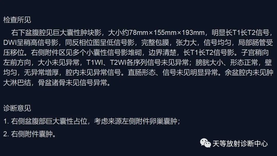 【病例】卵巢囊腺瘤1例MR影像-14