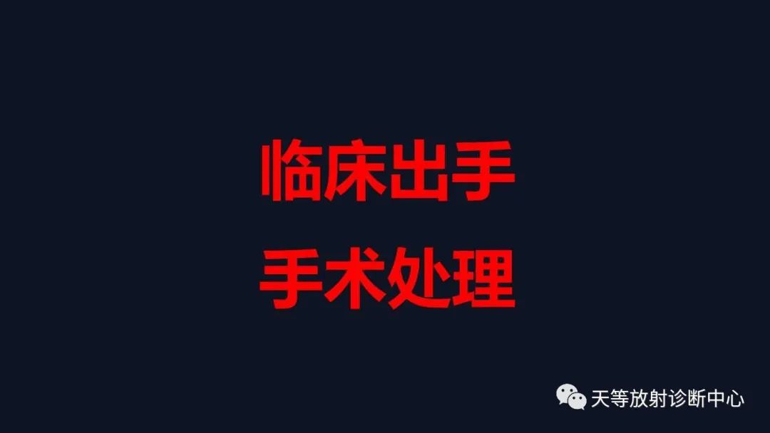 【病例】卵巢囊腺瘤1例MR影像-16