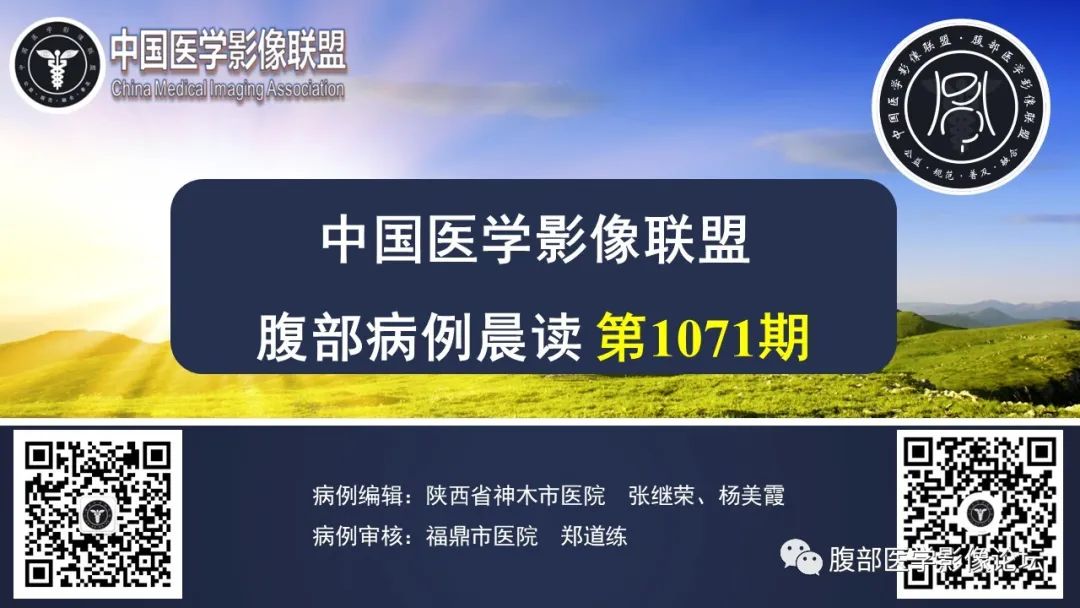 【病例】子宫内膜透明细胞癌1例MR-1