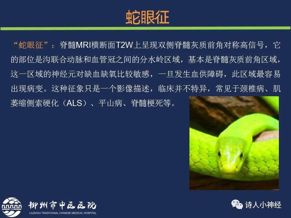 【PPT】“蛇眼征”影像汇总-3