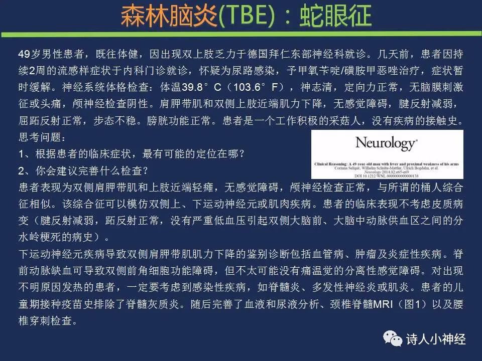 【PPT】“蛇眼征”影像汇总-26