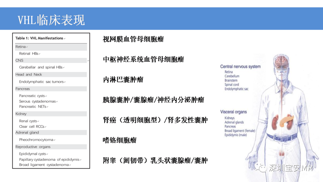 【PPT】VHL综合症及相关肿瘤-4