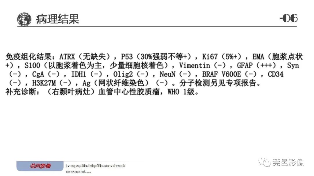 【病例】血管中心性胶质瘤一例分析-24