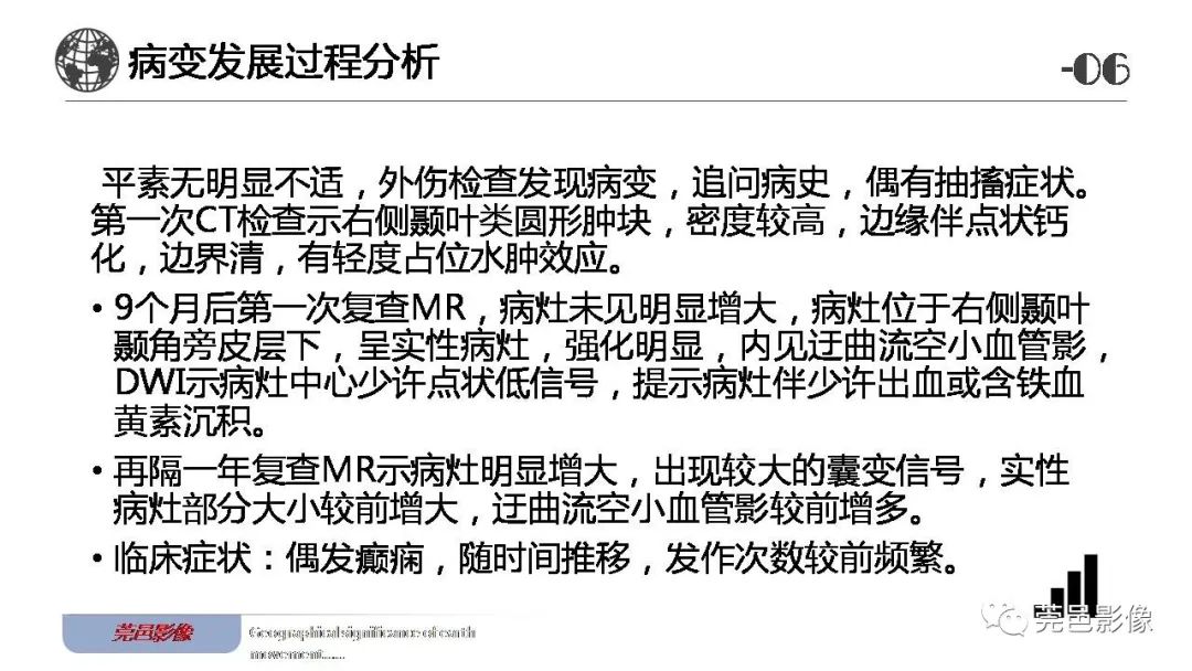 【病例】血管中心性胶质瘤一例分析-25