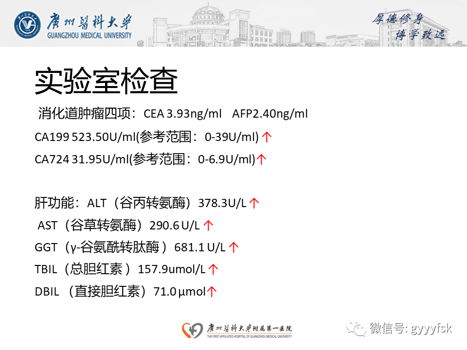 【PPT】胆管导管内乳头状肿瘤(IPNB)-3